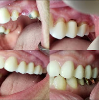 Before & After Restoration