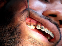 Orthodontic Treatment